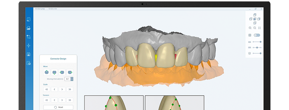 RAY - The Future of Face-Driven Dentistry